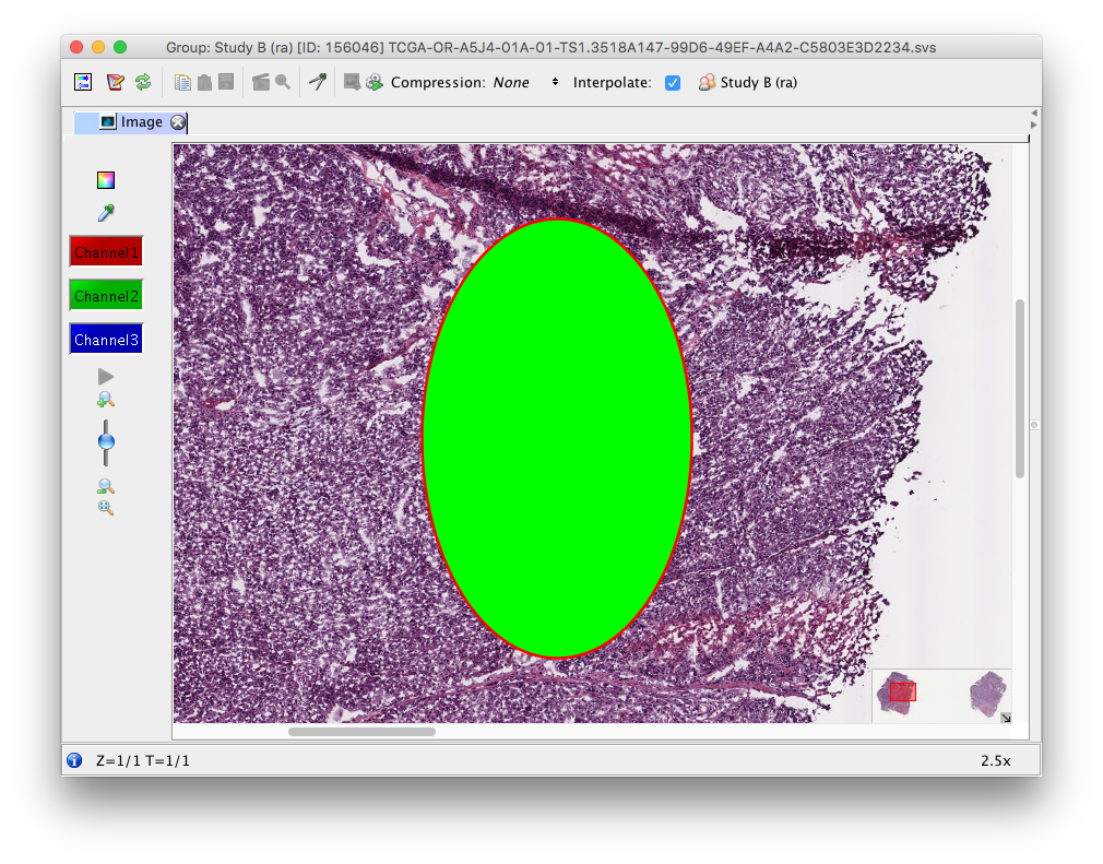 _images/ellipse_in_insight.png
