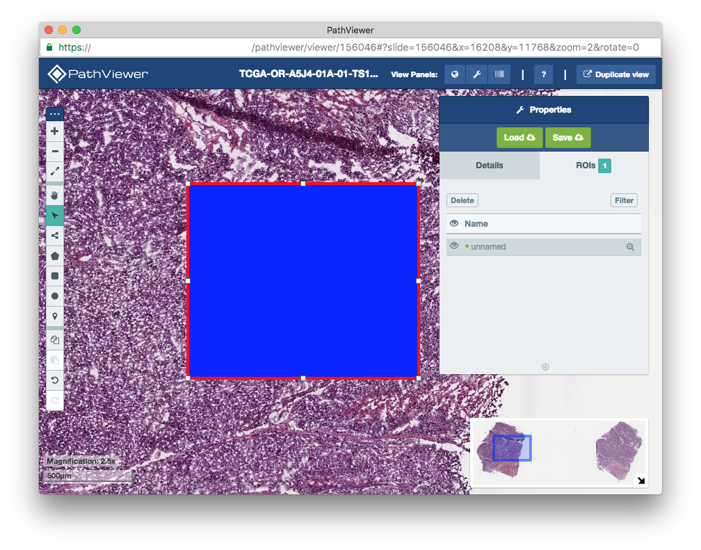 _images/roi_insight_in_pathviewer_1.1x.png