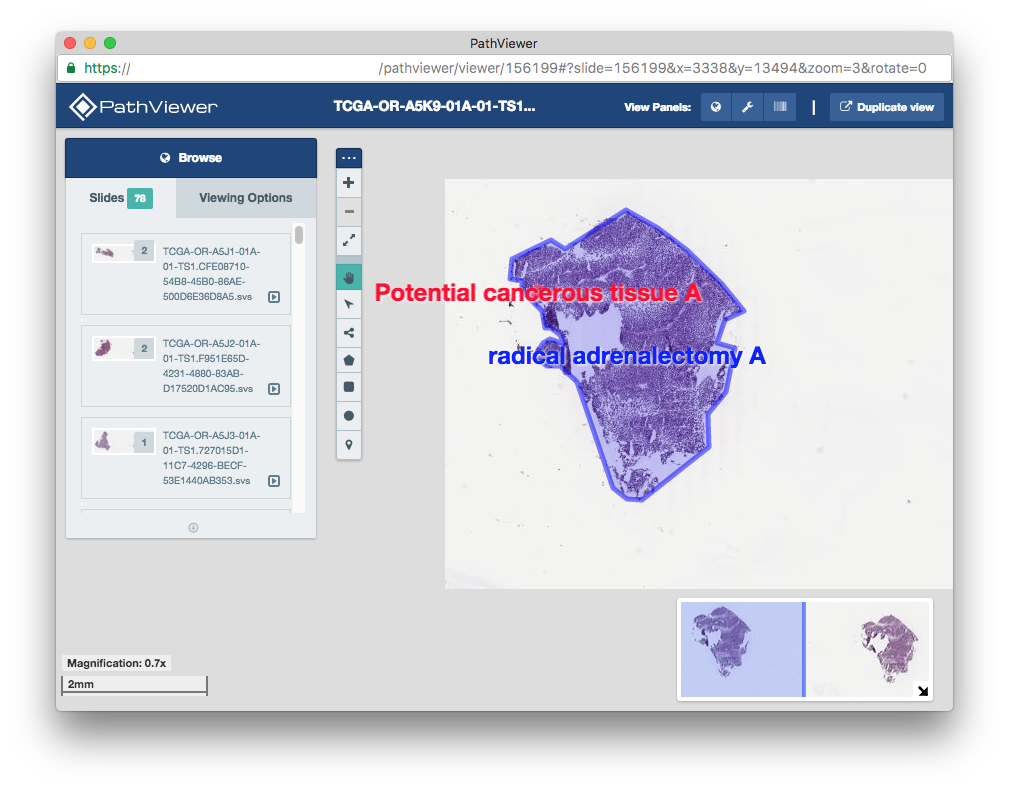 _images/roi_pathviewer_1.0x.png