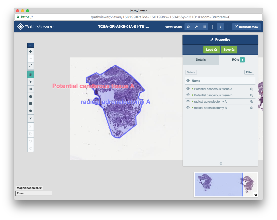 _images/roi_pathviewer_1.0x_in_pathviewer_1.1x.png
